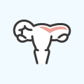 卵巣嚢腫イメージ